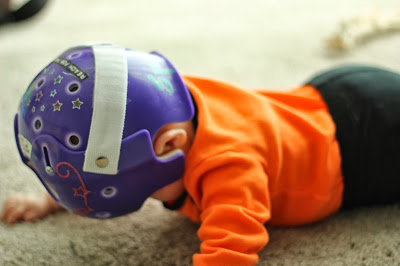 Cranial Helmets, Constipation and Crankyness… oh my!