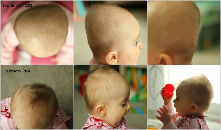 Another Helmet Update